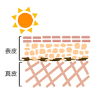 しみ