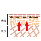 しみ