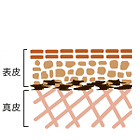 しみ