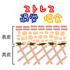 しみ